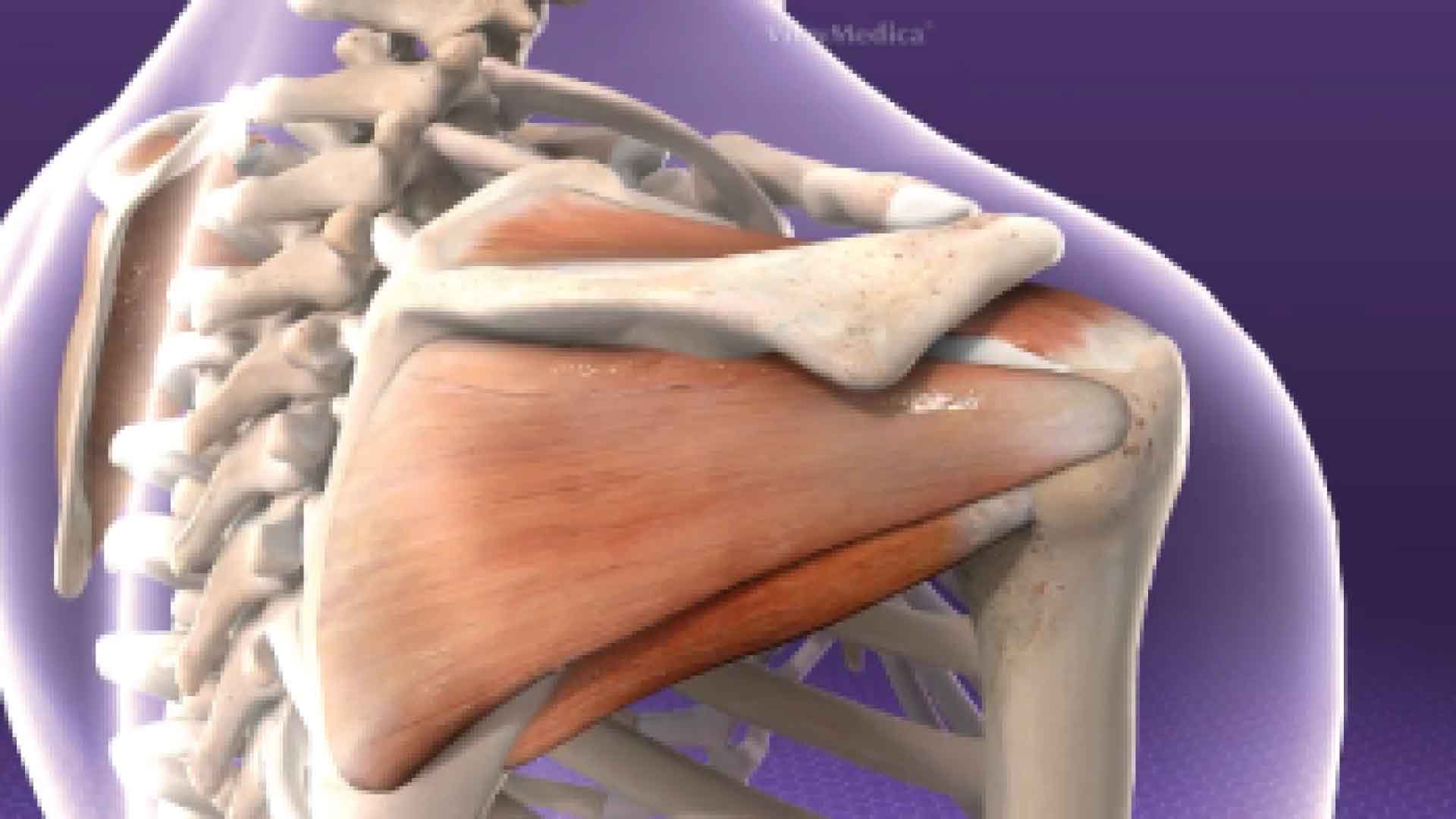 Rotator cuff pain